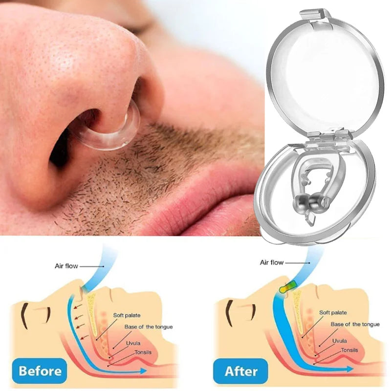 🔥 Anti-Snoring Snore Prevention Gadget Anti-Snore Device Snore Elimination Nose Sleep Night