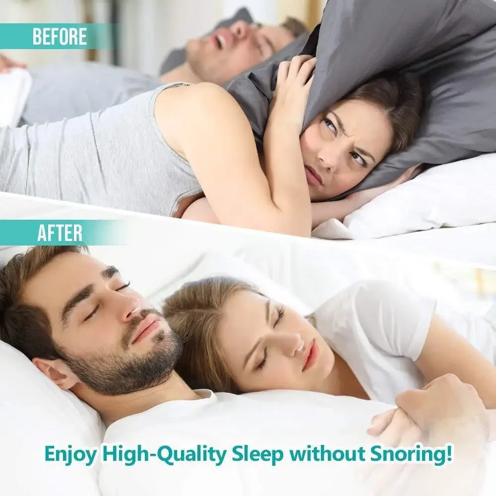 🔥 Anti-Snoring Snore Prevention Gadget Anti-Snore Device Snore Elimination Nose Sleep Night